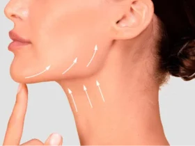 A Non-Surgical Approach to Jawline and Neck Definition