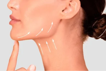 A Non-Surgical Approach to Jawline and Neck Definition