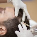 PRF Treatment in Edina