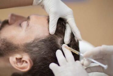 PRF Treatment in Edina