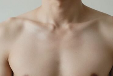Why Early Diagnosis Matters for Groin Hernia Patients