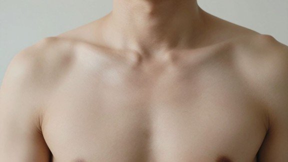 Why Early Diagnosis Matters for Groin Hernia Patients