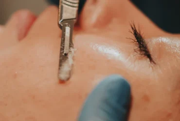 Precision Dermaplaning Treatment