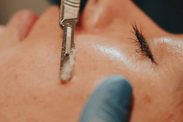 Precision Dermaplaning Treatment