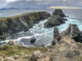 Morpheus8 in Northern Ireland: What Patients Should Know Before Booking