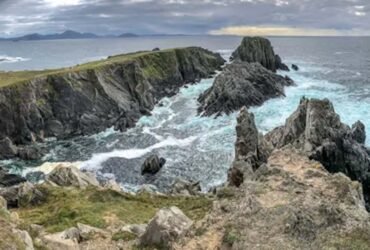 Morpheus8 in Northern Ireland: What Patients Should Know Before Booking