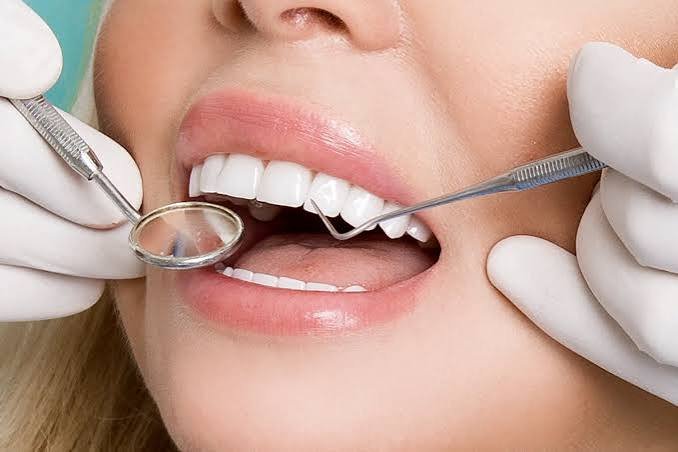Crafting Natural Smiles