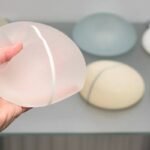 The Reality Of Living With Breast Implant Illness 