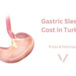 Gastric Sleeve Turkey Price: The NHS Route, the Private Route and the Istanbul Route Compared