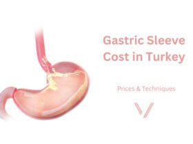 Gastric Sleeve Turkey Price: The NHS Route, the Private Route and the Istanbul Route Compared