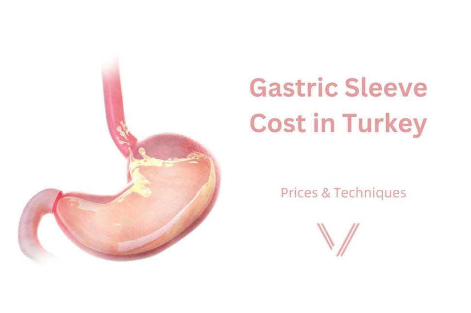 Gastric Sleeve Turkey Price: The NHS Route, the Private Route and the Istanbul Route Compared